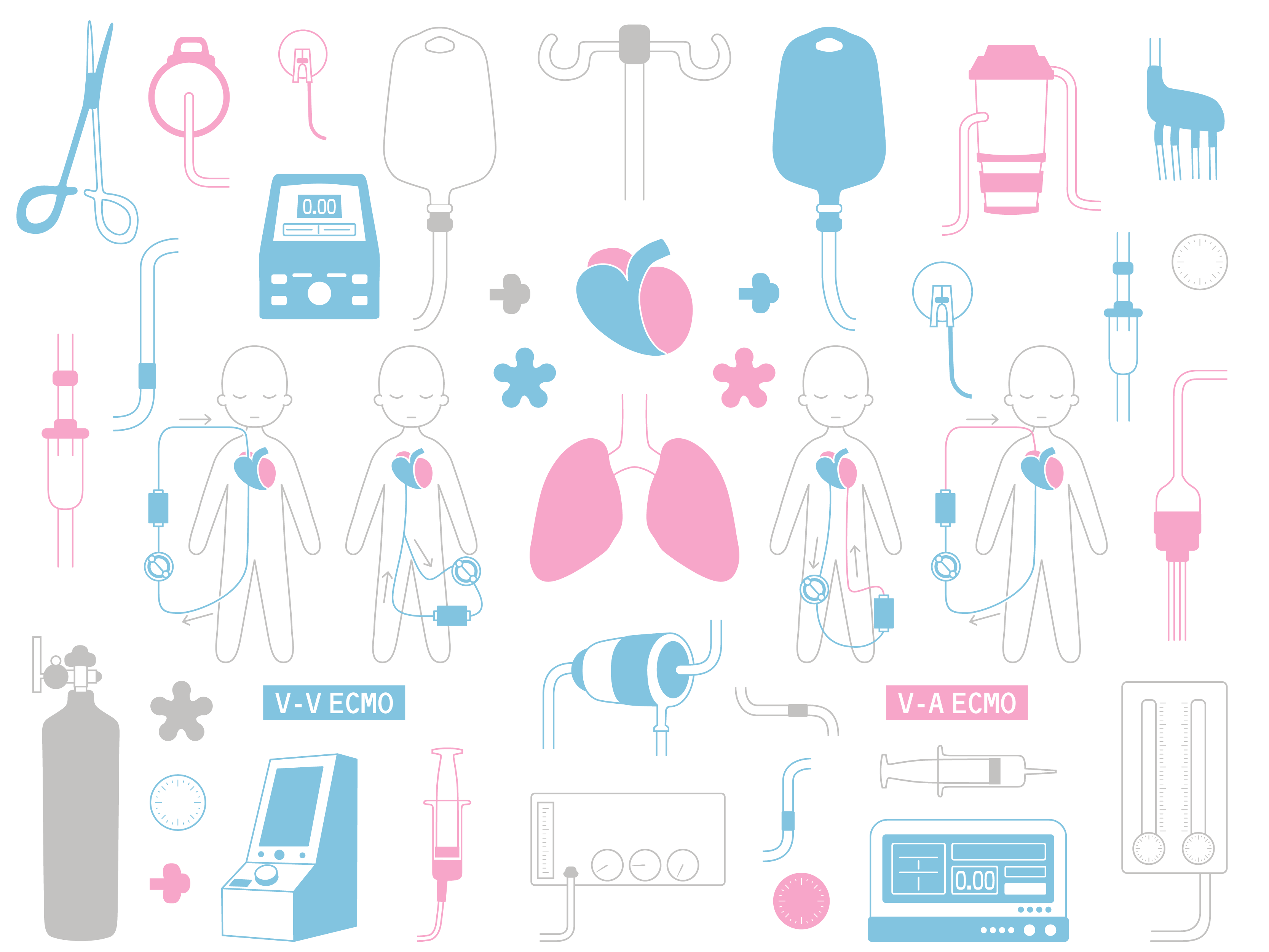 ひとりでできる補助循環；①ECMO | 内科医・研修医の駆け込み寺